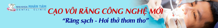 Răng đẹp hết ý - Không lo chi phí